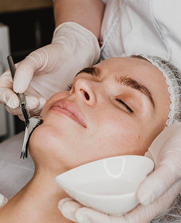 Chemical Peel Facial Treatment
