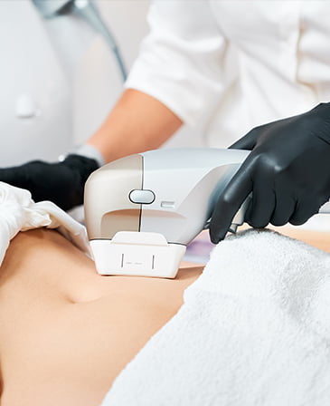 Cellulite and Fat reduction treatment
